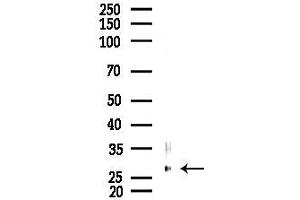 anti-Gem (Nuclear Organelle) Associated Protein 8 (GEMIN8) (C-Term) antibody