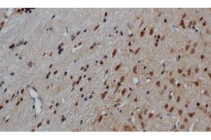 Immunohistochemistry of paraffin-embedded Mouse brain using GRP Polyclonal Antibody at dilution of 1:50 (Gastrin-Releasing Peptide anticorps)