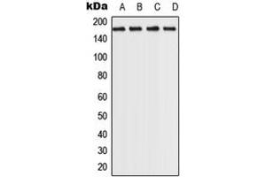 Western blot analysis of ROCK2 expression in MCf7 (A), HeLa (B), NIH3T3 (C), PC12 (D) whole cell lysates. (ROCK2 anticorps  (C-Term))