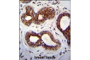 KIAA1586 Antibody immunohistochemistry analysis in formalin fixed and paraffin embedded human breast tissue followed by peroxidase conjugation of the secondary antibody and DAB staining. (KIAA1586 anticorps  (N-Term))