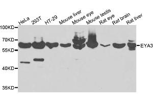 Western blot analysis of extracts of various cell lines, using EYA3 antibody (ABIN5975663) at 1/1000 dilution.