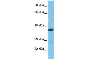Host:  Rabbit  Target Name:  NHRF1  Sample Type:  786-0 Whole Cell lysates  Antibody Dilution:  1.