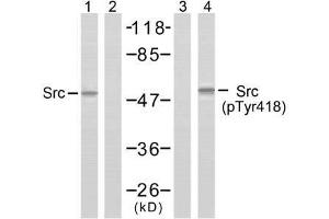 Western blot analysis of extracts from COLO205 cells using Src (Ab-418) antibody (E021115, Lane 1 and 2) and Src (phospho-Tyr418) antibody (E011091, Lane 3 and 4). (Src anticorps  (pTyr418))