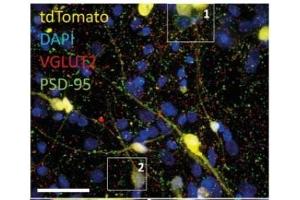 40x confocal images of mixed excitatory/inhibitory iN co-culture on astrocytes containing a small fraction of tdTomato-expressing iN cells. (tdTomato anticorps)