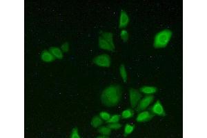 Figure:FITC staining on IHC-P Simple: Hela cells (CYP1A2 anticorps  (AA 192-444))
