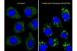 Immunofluorescent analysis of U251 cells using LC3B antibody.