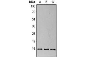 Western blot analysis of 4EBP1 (pT37) expression in HEK293T insulin-treated (A), NIH3T3 insulin-treated (B), PC12 insulin-treated (C) whole cell lysates. (eIF4EBP1 anticorps  (N-Term, pSer37))