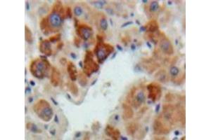Used in DAB staining on fromalin fixed paraffin-embedded Liver tissue (Hepcidin anticorps  (AA 24-83))