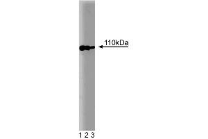 Western blot analysis of Sec8 on a MDCK cell lysate (Canine kidney, ATCC CCL-34). (Sec8 anticorps  (AA 31-201))