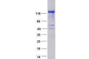 Validation with Western Blot