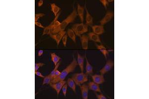 Immunofluorescence analysis of NIH-3T3 cells using eIF3B Rabbit mAb (ABIN7267042) at dilution of 1:100 (40x lens). (EIF3B anticorps)