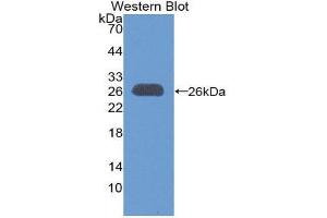 Western Blotting (WB) image for anti-B-Cell CLL/lymphoma 9 (BCL9) (AA 1118-1327) antibody (ABIN1866886) (BCL9 anticorps  (AA 1118-1327))