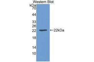 Detection of Recombinant LEP, Mouse using Monoclonal Antibody to Leptin (LEP) (Leptin anticorps  (AA 22-167))
