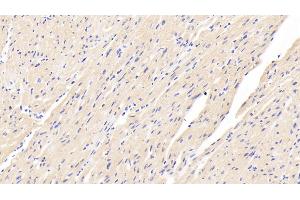 Detection of CASP12 in Human Cardiac Muscle Tissue using Polyclonal Antibody to Caspase 12 (CASP12)