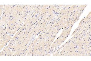 Detection of CASP12 in Human Cardiac Muscle Tissue using Polyclonal Antibody to Caspase 12 (CASP12) (Caspase 12 anticorps  (AA 101-337))