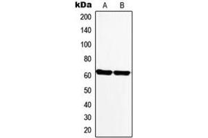 Western blot analysis of Monoamine Oxidase A expression in PC12 (A), Human heart (B) whole cell lysates. (Monoamine Oxidase A anticorps  (Center))
