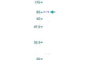 SDS-PAGE (SDS) image for serum/glucocorticoid Regulated Kinase 1 (SGK1) (AA 1-431) protein (GST tag) (ABIN1784630)