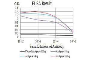 Black line: Control Antigen (100 ng),Purple line: Antigen (10 ng), Blue line: Antigen (50 ng), Red line:Antigen (100 ng) (IL2 Receptor beta anticorps  (AA 27-240))