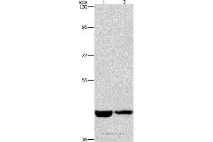 Western blot analysis of Hela and A431 cell, using CSNK1E Polyclonal Antibody at dilution of 1:1550 (CK1 epsilon anticorps)