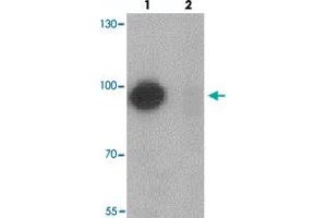 Western blot analysis of TSHZ1 in A-20 cell lysate with TSHZ1 polyclonal antibody  at 1 ug/mL in (lane 1) the absence and (lane 2) the presence of blocking peptide. (TSHZ1 anticorps  (N-Term))