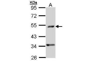 WB Image Sample (30 ug of whole cell lysate) A: A431 , 10% SDS PAGE antibody diluted at 1:1000 (PDSS2 anticorps)