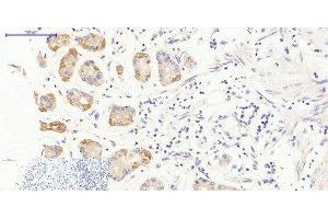 Immunohistochemistry of paraffin-embedded Human stomach tissue using JAK3 Polyclonal Antibody at dilution of 1:200. (JAK3 anticorps)