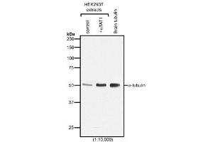 Western blot analysis of protein acetylation with anti-α-Tubulin (acetylated), mAb (TEU318) . (alpha Tubulin anticorps)