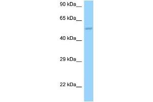 WB Suggested Anti-HARS2 Antibody Titration: 1. (HARS2 anticorps  (N-Term))