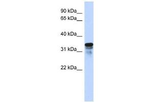 FAM82B antibody used at 1 ug/ml to detect target protein. (FAM82B anticorps  (N-Term))