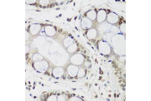 Immunohistochemistry of paraffin-embedded human gastric using CBX3 antibody (ABIN5971255) at dilution of 1/200 (40x lens). (CBX3 anticorps)