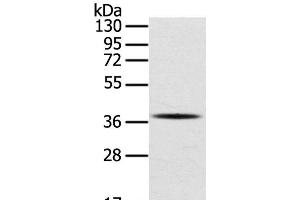 Western Blot analysis of A375 cell using SPARC Polyclonal Antibody at dilution of 1:400 (SPARC anticorps)