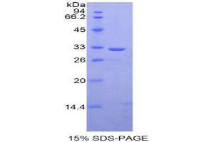 SDS-PAGE analysis of Mouse STAT1 Protein.