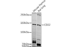 Western blot analysis of extracts of various cell lines, using CD22 antibody (ABIN6131253, ABIN6138143, ABIN6138144 and ABIN6221471) at 1:1000 dilution.