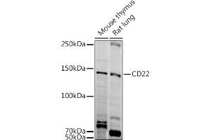 Western blot analysis of extracts of various cell lines, using CD22 antibody (ABIN6131253, ABIN6138143, ABIN6138144 and ABIN6221471) at 1:1000 dilution. (CD22 anticorps  (AA 708-847))