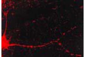 CaMKII Immunofluorescence.