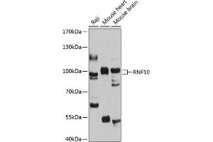 Western blot analysis of extracts of various cell lines, using RNF10 antibody (ABIN6128687, ABIN6147001, ABIN6147002 and ABIN6215902) at 1:1000 dilution. (RNF10 anticorps  (AA 552-811))