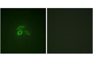 Immunofluorescence analysis of HepG2 cells, using CD227/MUC1 (Phospho-Tyr1229) Antibody. (MUC1 anticorps  (pTyr1229))