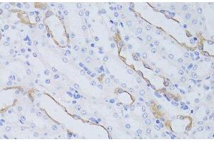 Immunohistochemistry of paraffin-embedded Mouse kidney using Aquaporin 4 Polyclonal Antibody at dilution of 1:50 (40x lens). (Aquaporin 4 anticorps)