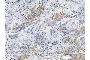 ABIN6255087 and ABIN6267322 at 1/100 staining human normal placenta tissue by IHC-P. (EIF4E anticorps  (pSer209))