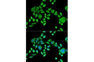 Immunofluorescence analysis of HeLa cells using SH3GL2 antibody (ABIN6132118, ABIN6147725, ABIN6147726 and ABIN6221363). (SH3G2 anticorps  (AA 1-270))