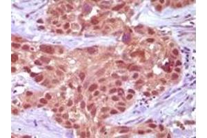 Immunohistochemistry (IHC) image for anti-Mismatch Repair Protein 2 (MSH2) antibody (ABIN2464085) (MSH2 anticorps)