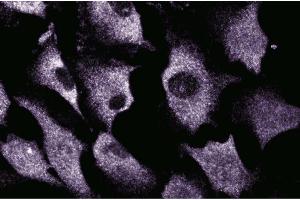 Immunofluorescent staining of EaHy cells. (SRPK1 anticorps  (AA 312-434))