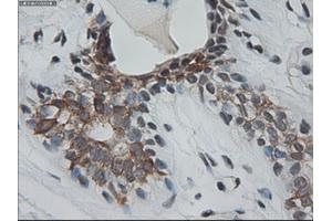 Immunohistochemical staining of paraffin-embedded breast using anti-KRT18 (ABIN2452646) mouse monoclonal antibody. (Cytokeratin 18 anticorps  (AA 69-372))