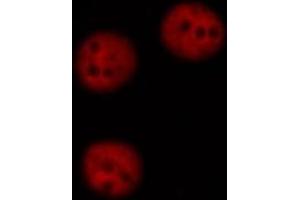 DF6176 staining HEPG2 cells by ICC/IF.