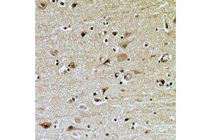Immunohistochemical analysis of ZNRF2 staining in human brain formalin fixed paraffin embedded tissue section. (ZNRF2 anticorps  (C-Term))