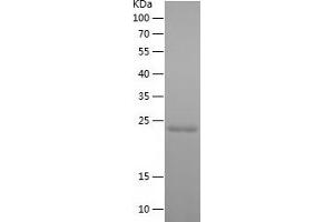 Western Blotting (WB) image for Glyoxalase I (GLO1) (AA 2-184) (Active) protein (His tag) (ABIN7123173)