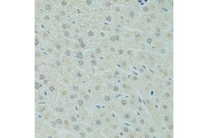 Immunohistochemistry of paraffin-embedded mouse liver using RCC1 antibody. (RCC1 anticorps  (AA 1-240))