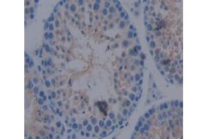 IHC-P analysis of Mouse Tissue, with DAB staining. (ACVR2A anticorps  (AA 20-95))