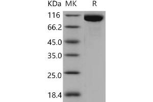 Western Blotting (WB) image for Toll-Like Receptor 3 (TLR3) protein (His tag) (ABIN7320391)
