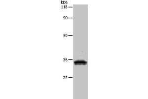 Western Blot analysis of 293T cell using UPK3B Polyclonal Antibody at dilution of 1:1000 (Uroplakin 3B anticorps)